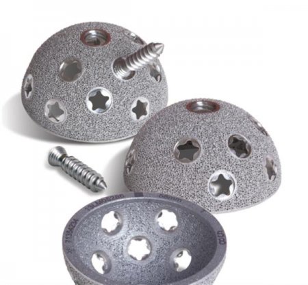 施乐辉发布首个3D打印钛金属髋关节植入物