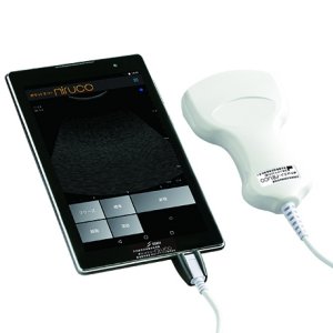 日本希格玛推出平板型超声波诊断仪
